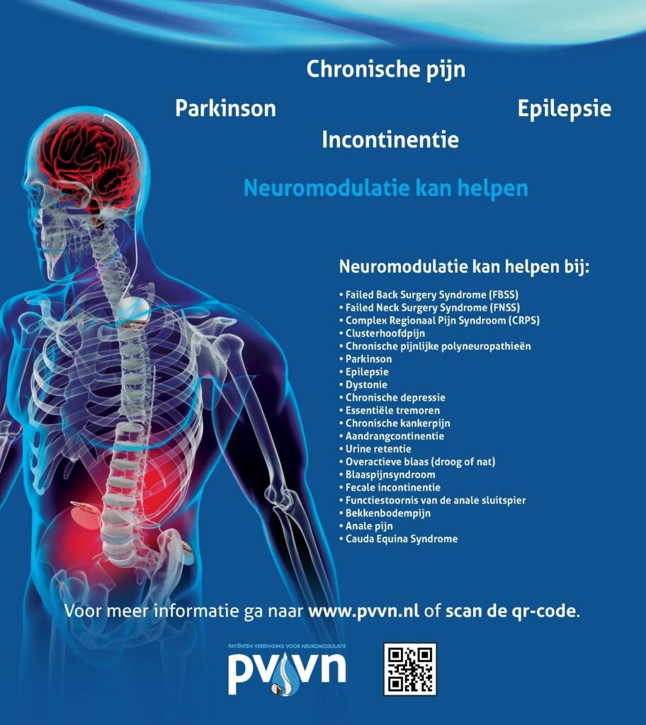 Algemene advertentie zonder kop