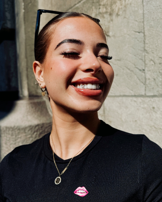 foto toothgems verkleind